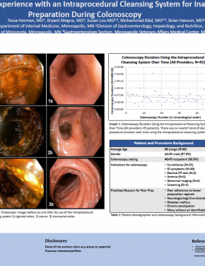 A Single-Center Clinical Experience with an Intraprocedural Cleansing System for Inadequate Bowel Preparation During Colonoscopy. ACG2022 Download